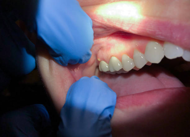 Best Cosmetic Emergency Dentistry in Pontotoc, MS