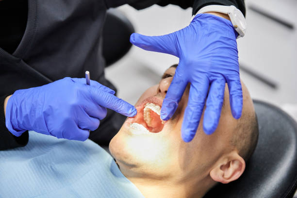 Best Urgent Care for Lost Fillings or Crowns in Pontotoc, MS